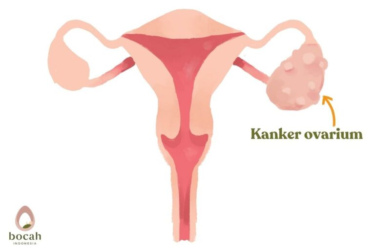 Macam-macam Kanker Paling Generik di Usia di Rendah 50 Tahun